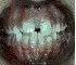 Teeth